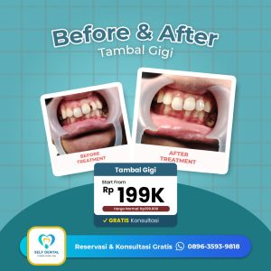 Testimoni Tambal Gigi 2