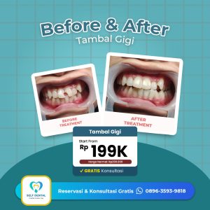 Testimoni Tambal Gigi 2